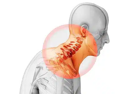 discover the latest cervical disc herniation treatment options, including non-surgical therapies, surgical procedures, and recovery tips to help relieve neck pain and restore mobility.