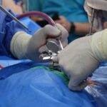 learn about herniated discs, including causes, symptoms, treatment options, and recovery tips to help manage pain and improve spine health.