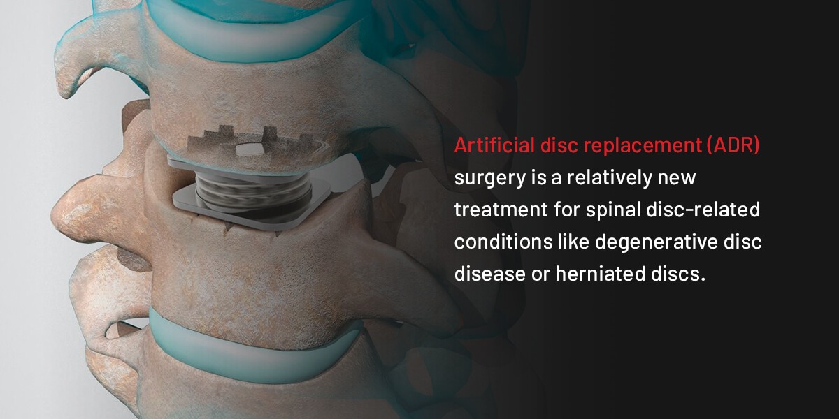 discover proven tips and treatments for herniated disc success. learn how to relieve pain, improve mobility, and achieve long-term recovery with expert advice and real-life stories.