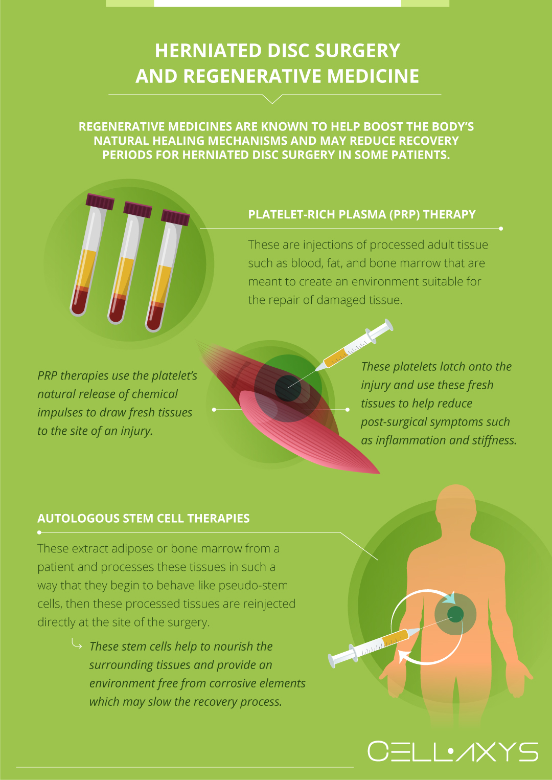 discover effective treatments and inspiring recovery stories for herniated discs. learn tips for pain relief, rehabilitation, and achieving long-term success with your spine health.