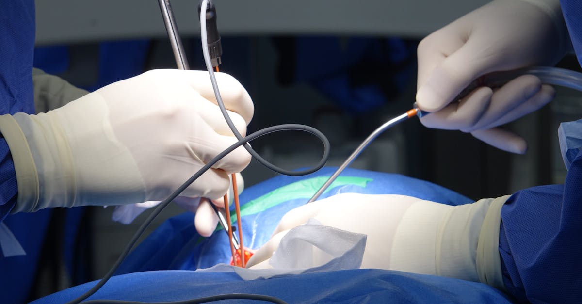 learn about herniation, its causes, symptoms, types, and best treatment options. get expert insights and tips on managing and preventing herniation effectively.