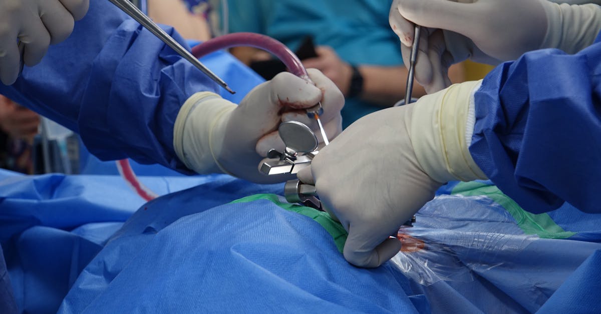 learn about lumbar stenosis, its causes, symptoms, diagnosis, and the latest treatment options to help manage back pain and improve mobility.