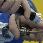 discover the benefits of minimally invasive surgery, including reduced pain, faster recovery, and minimal scarring. learn how advanced surgical techniques offer safer and more effective treatment options.
