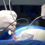 discover the benefits of minimally invasive surgery, a modern medical approach that uses small incisions, resulting in less pain, faster recovery, and reduced scarring compared to traditional surgical methods.