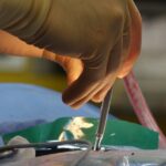 discover the benefits, techniques, and latest advancements in minimally invasive surgery. learn how these procedures offer quicker recovery times, less pain, and better outcomes for a variety of medical conditions.