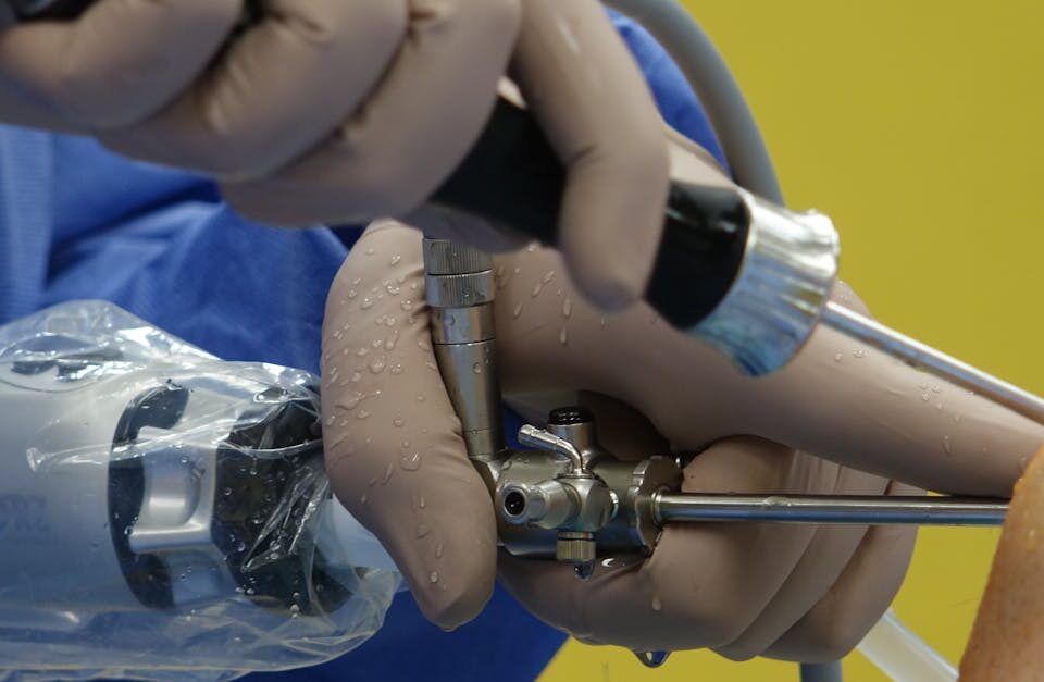 discover the benefits of minimally invasive surgery, including reduced pain, faster recovery, and minimal scarring. learn how advanced surgical techniques offer safer and more effective treatment options.