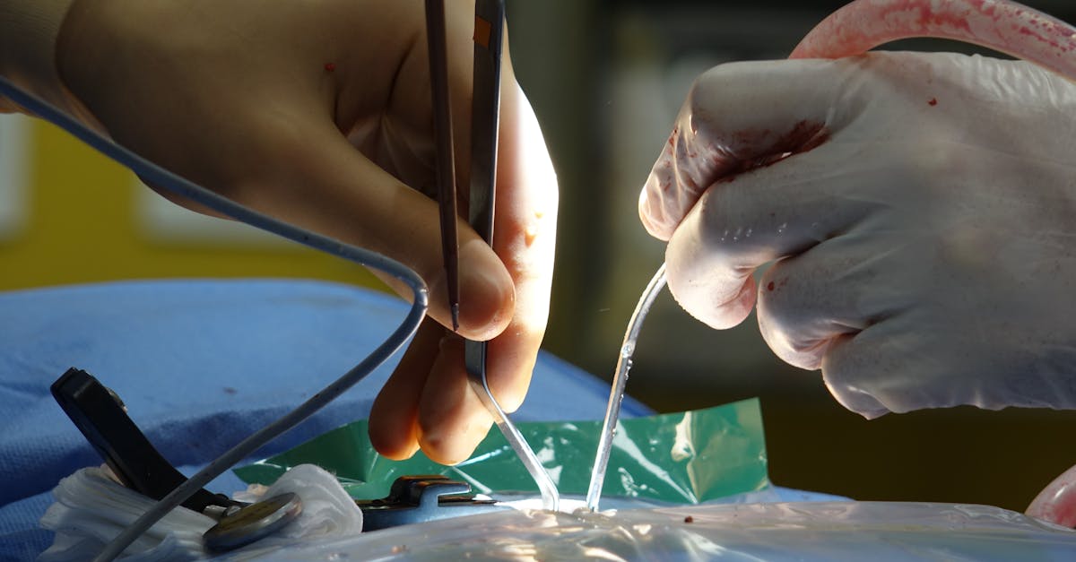 discover comprehensive information about spine surgery, including procedures, recovery tips, risks, and how to choose the right specialist for your spinal health needs.