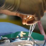 discover everything you need to know about spine surgery, including procedures, recovery tips, and expert advice to help you make informed decisions about your spinal health.