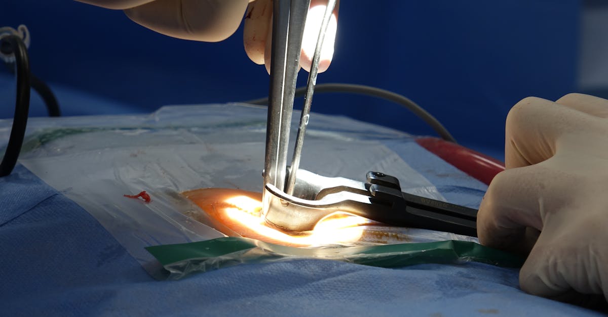 discover comprehensive information about spine surgery, including types, procedures, recovery tips, and expert advice to help you make informed decisions about your spinal health.