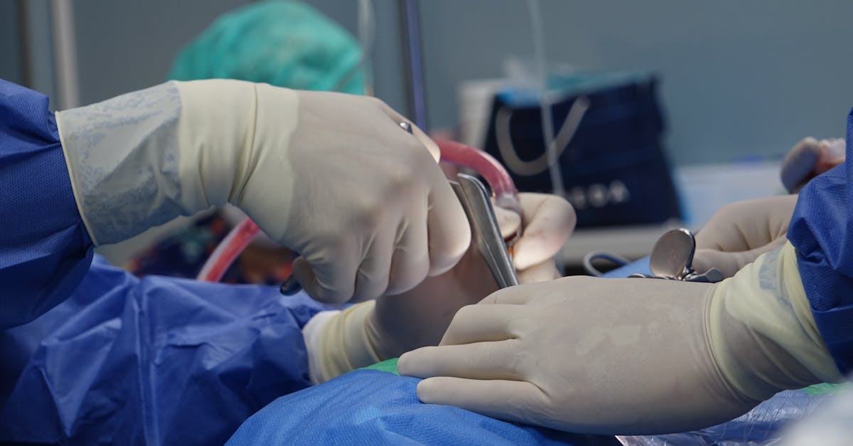 discover expert information about spine surgery, including procedures, recovery tips, and how to choose the right surgeon for your spinal health needs.