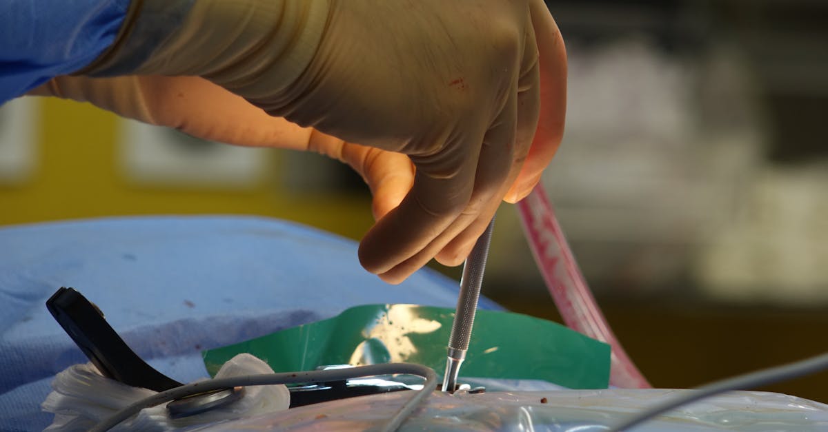 discover comprehensive information about spine surgery, including procedures, benefits, risks, and recovery tips to help you make informed decisions about your spinal health.