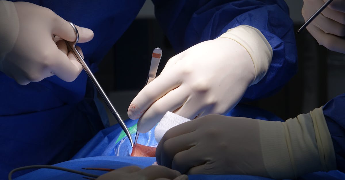 discover essential information about spine surgery, including procedures, recovery process, risks, and expert tips to ensure the best results for your spinal health.