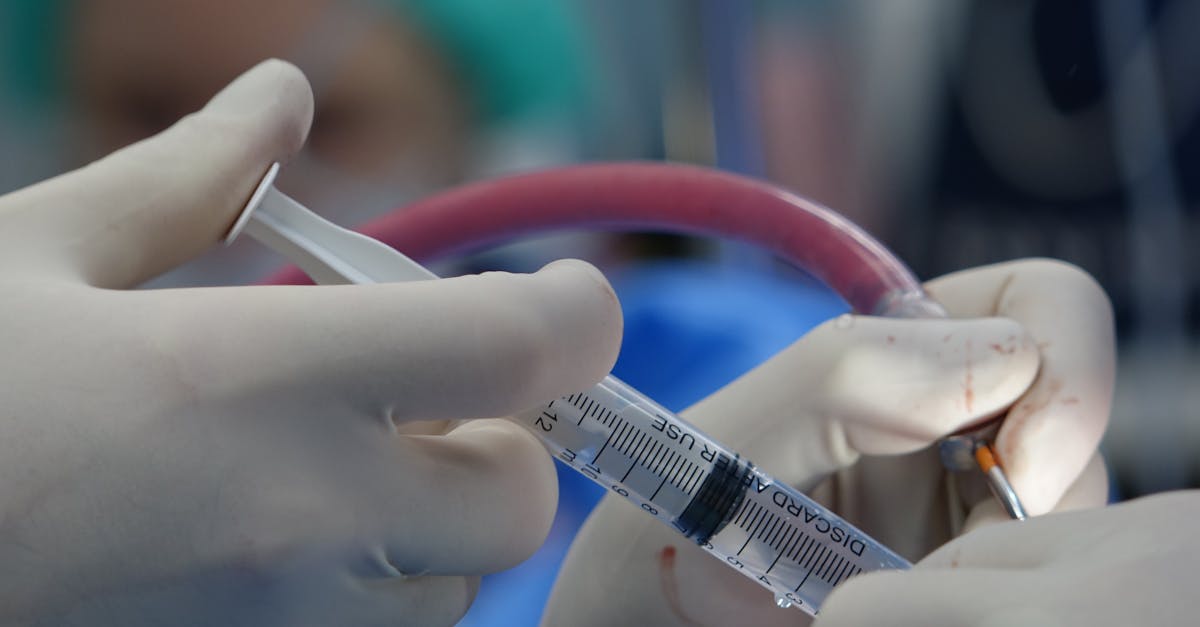 learn about spine surgery, including types of procedures, recovery tips, risks, and benefits. find expert advice to help you make informed decisions about spinal health and treatments.