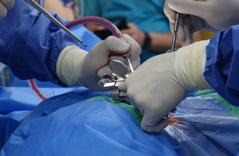 discover the latest advancements in spine surgery, including minimally invasive techniques, recovery tips, and expert insights to help you make informed decisions about your spinal health.