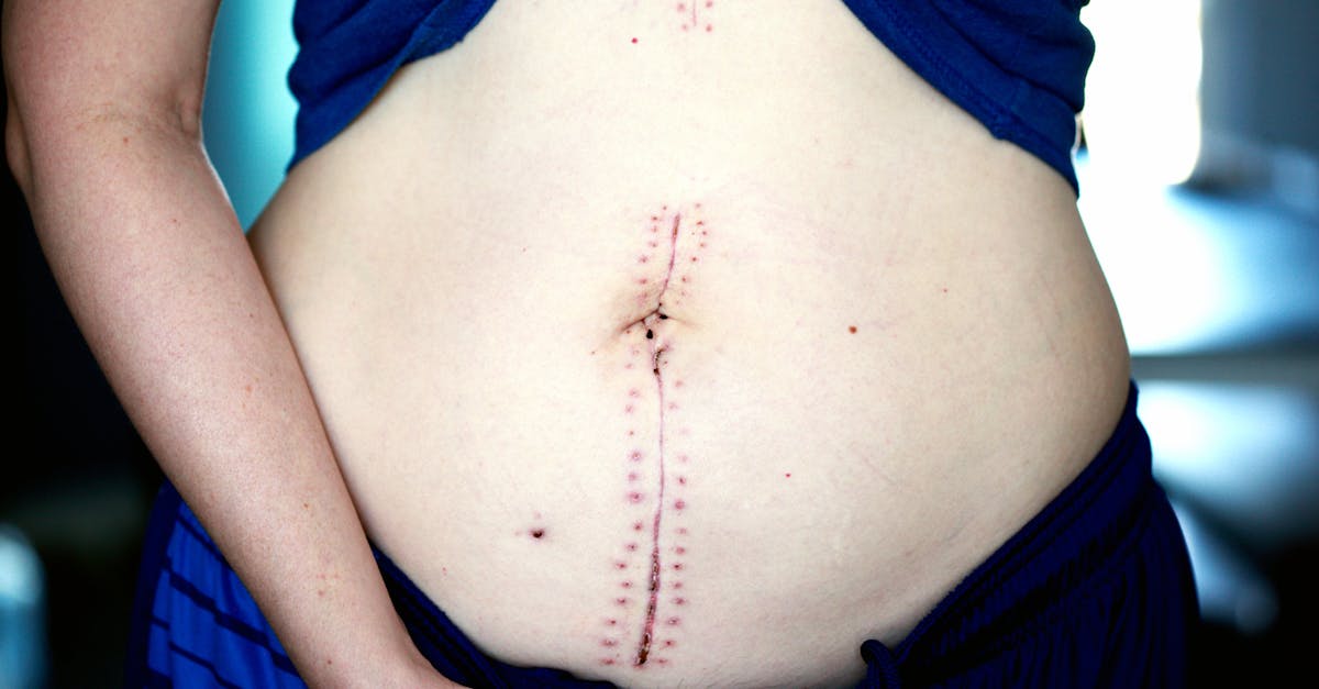 discover essential information about surgery, including types, procedures, preparation tips, risks, benefits, and recovery advice to help you make informed decisions about your health.